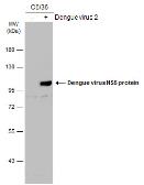 Anti-Dengue virus NS5 protein antibody used in Western Blot (WB). GTX103350
